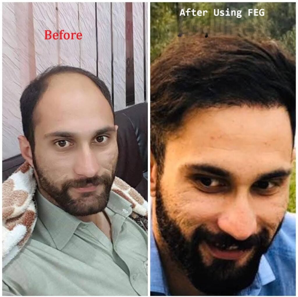 Image #1 from M Umair