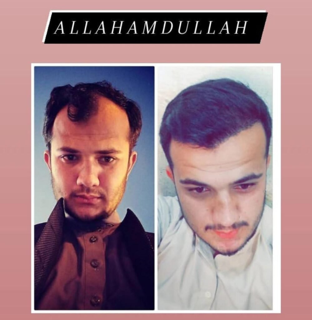 Image #1 from Ali Zain